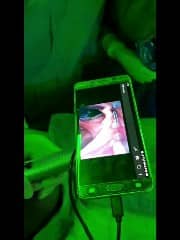 video laryngoscope android UVC disinfection and video laryngoscopes